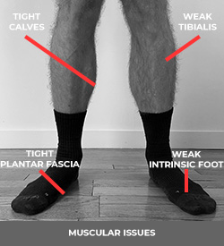 https://myhealthsciences.com/wp-content/uploads/2022/12/Pronation-Distortion-Syndrome-Muscles-V3.jpg